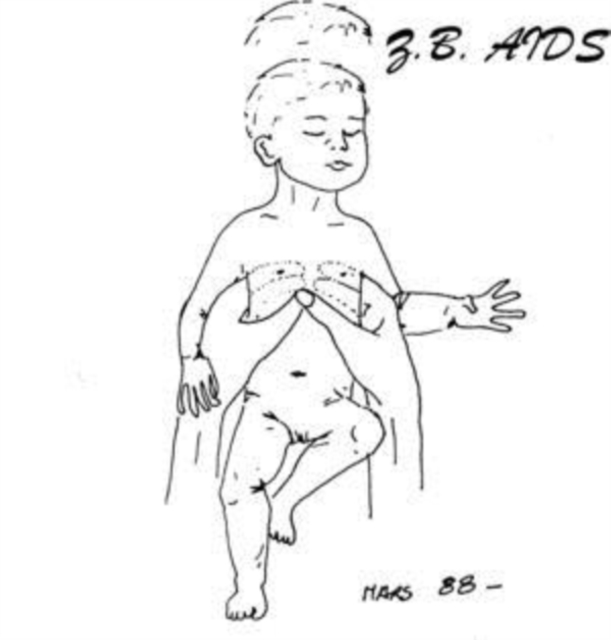 Z.B. AIDS - GESTALT (IMPORT) - LP Vinyl